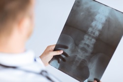Radiology Services available to you from Ontario Chiropractic